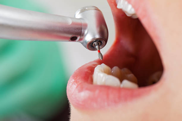 Best Emergency Dental Extractions in Manistee, MI